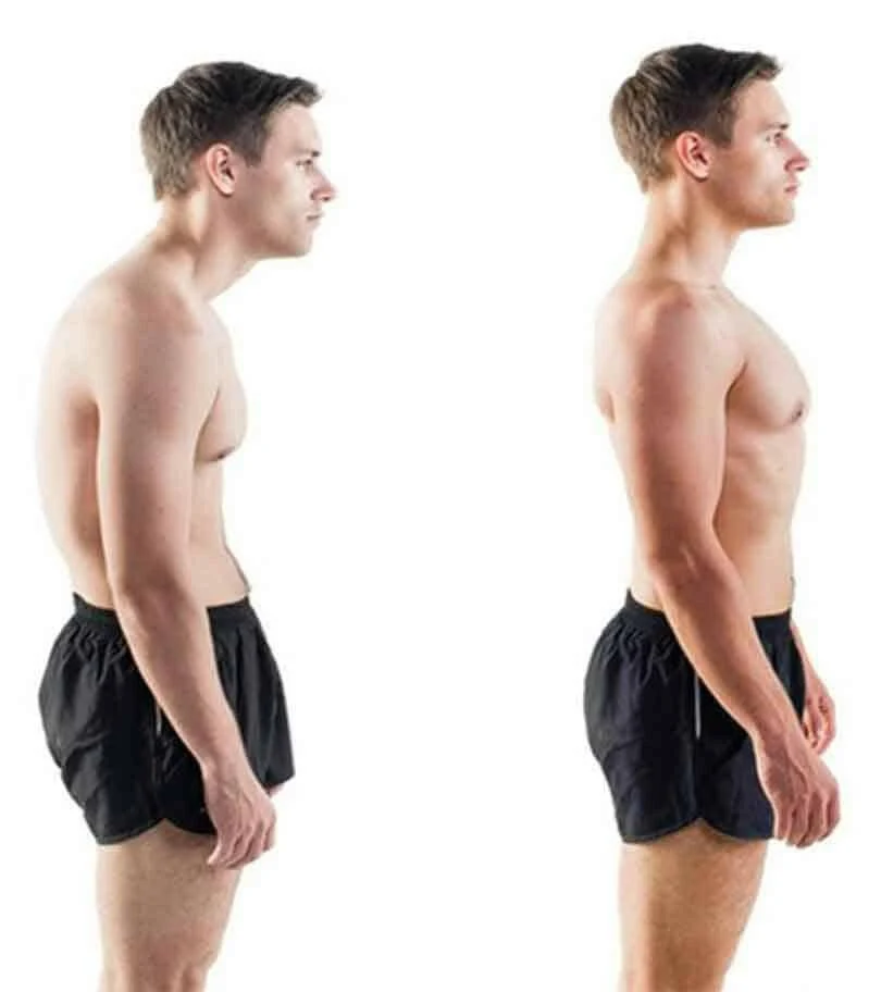 Ryggfix™ - Posture Corrector - Image 3